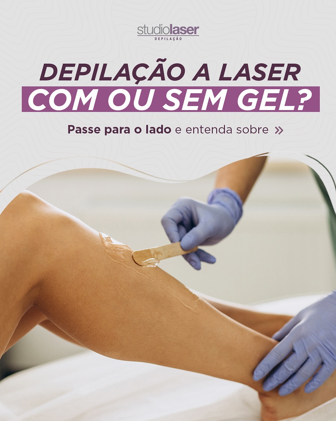 Conforto e beleza: depilação sem gel no Studio Laser!