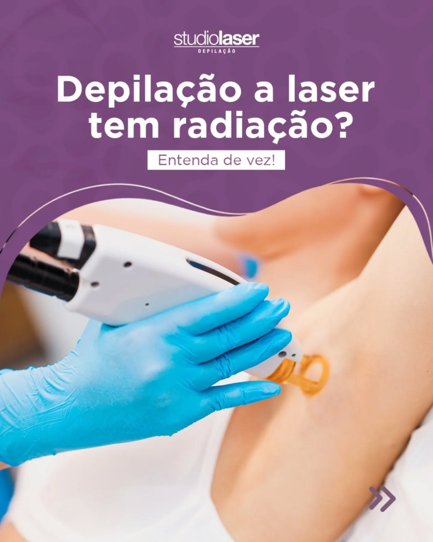 Depilação a Laser: Segurança e Eficácia Comprovadas!
