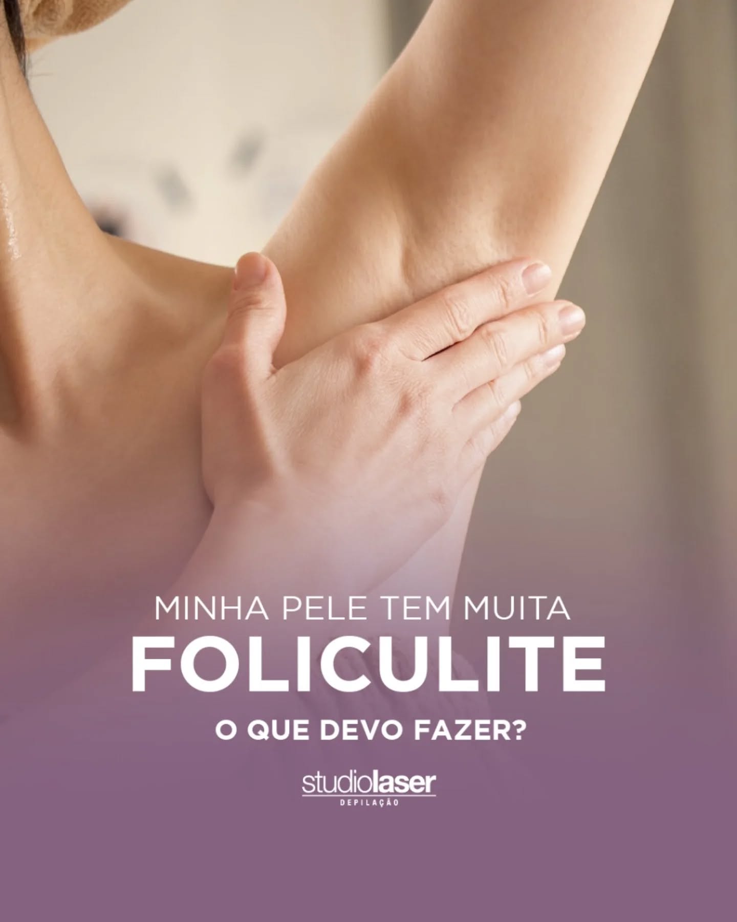 Acabe com a foliculite: Dicas para uma pele saudável!
