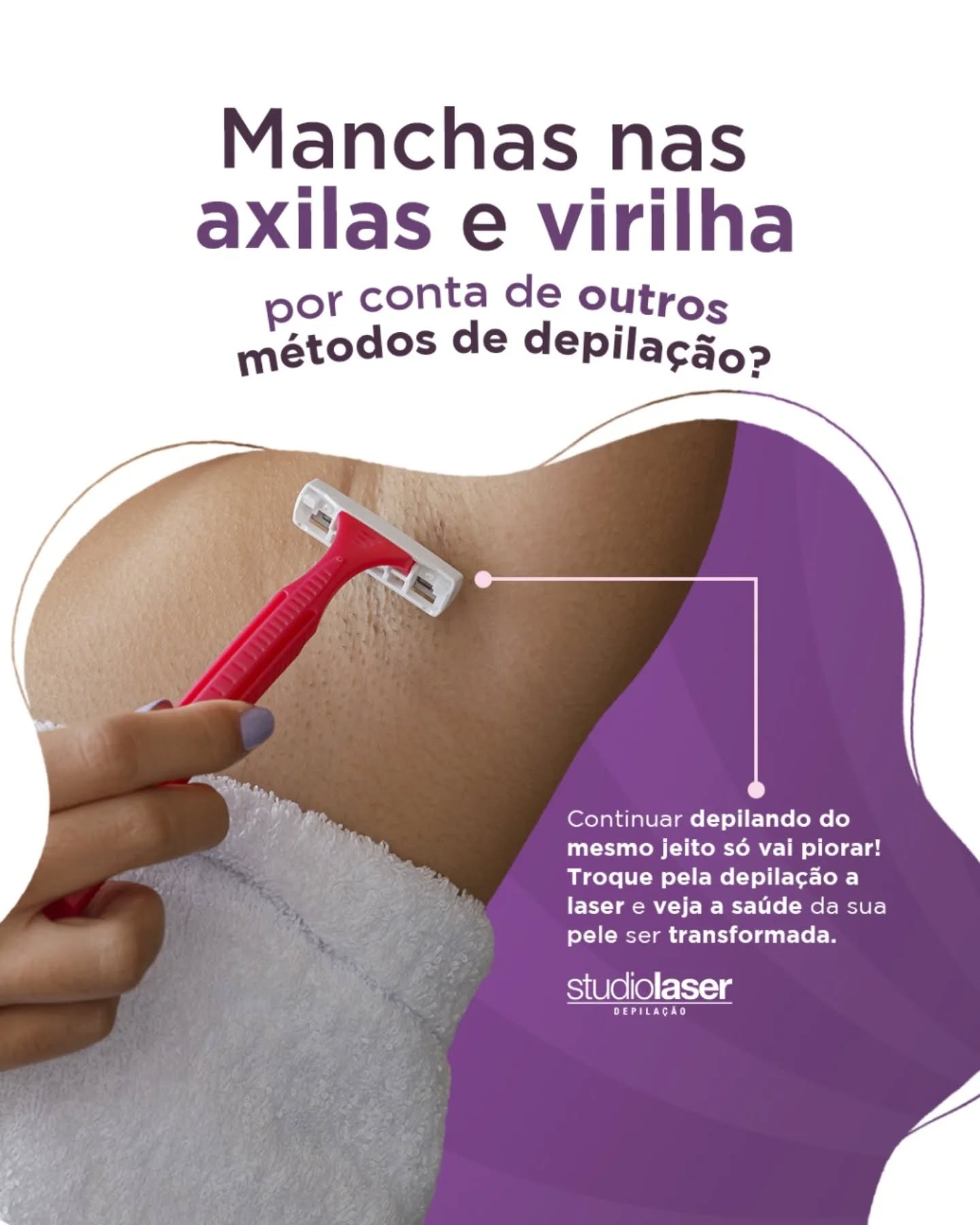Depilação a Laser: Pele Lisa sem Manchas e Irritações!