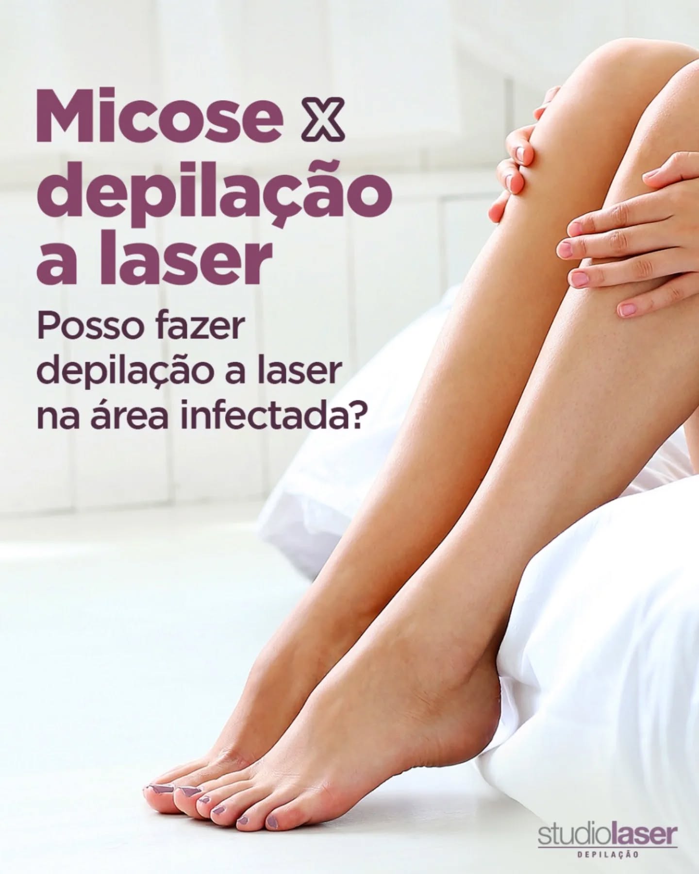 Depilação a Laser: Cuide da Pele com Micose Primeiro