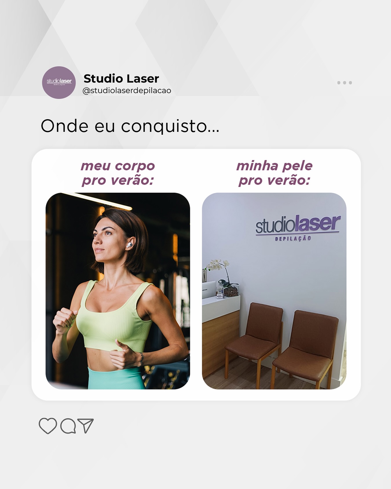 Verão sem pelinhos: Pele impecável no Studio Laser