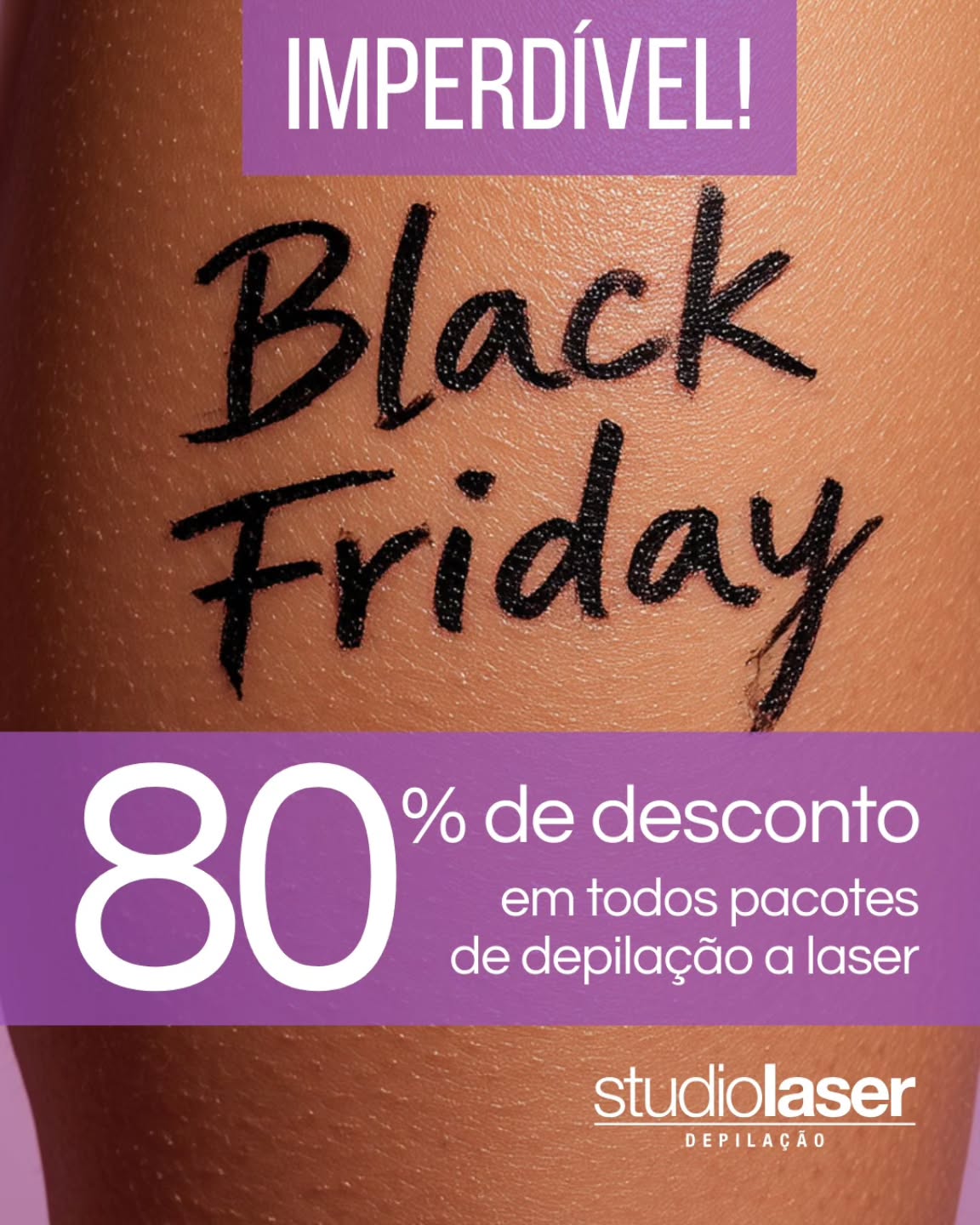 Black Friday Studio Laser: Laser com até 80% Off!